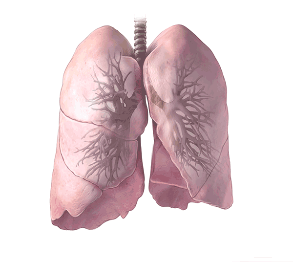 肺部有问题喉咙先知出现这2个信号别再以为是咽炎了