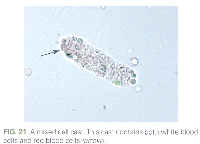 混合管型专家共识解读与探讨
