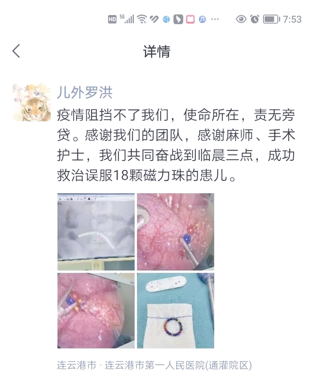 误吞磁力珠对那边影响最大_假如误食磁力珠会有什么表现（误吞磁力珠对哪里影响最大）