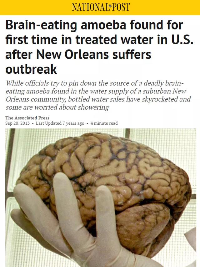 孩子感染自来水里食脑虫死了!加拿大小心这些地方