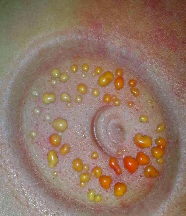 男性壮阳拔罐_男性壮阳拔罐图解（男性壮阳拔罐的位置图）