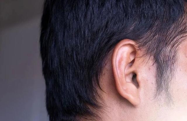 22岁小伙的耳朵患上"脚气病"!只因