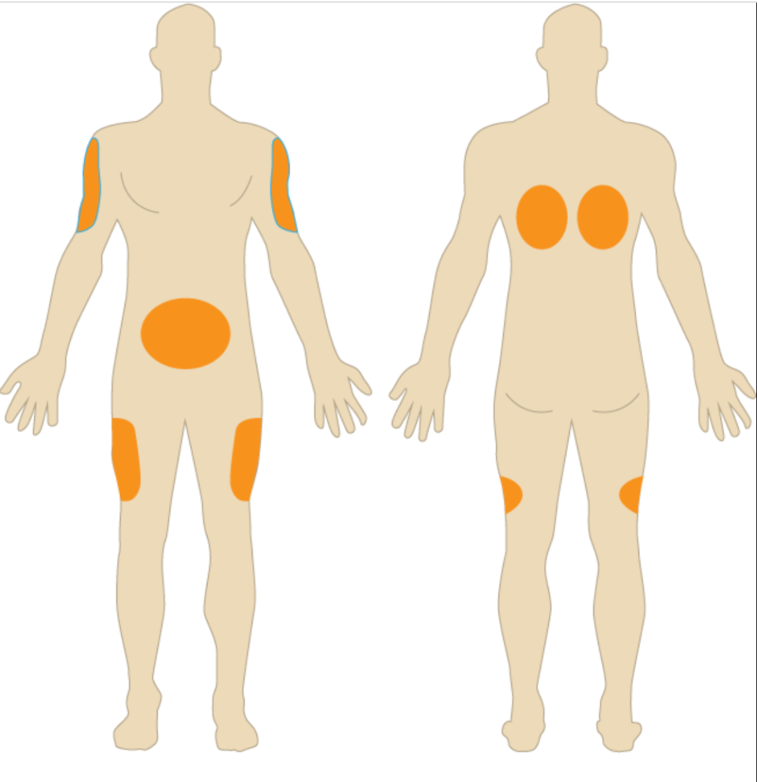 小时候流行的"屁股针",为什么消失了?