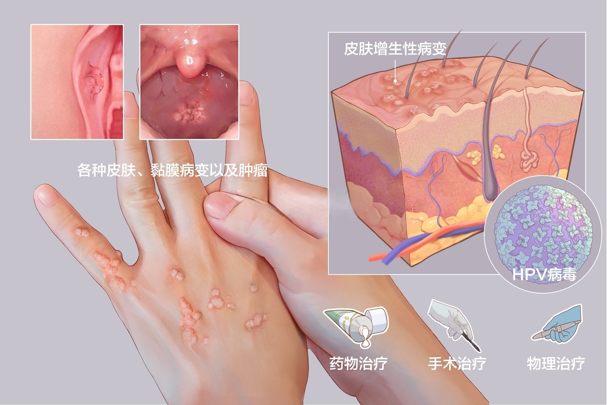 hpv的两个特点是什么?