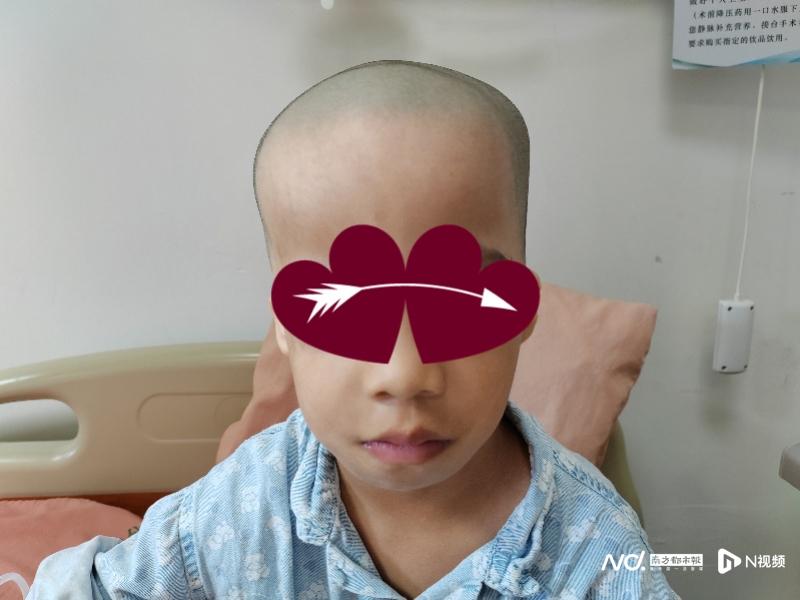 罹患鸟面综合征失聪,公益资助下手术让女孩"听见春天"