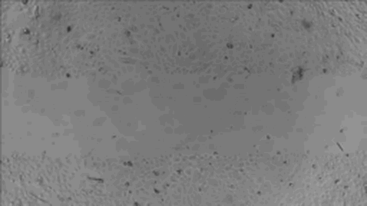 解读文献里的那些图——细胞迁移实验