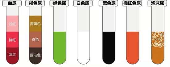 紅尿,藍尿,綠尿……嚇cry了吧!一文讀懂