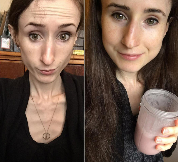 瘦脱相了是什么意思