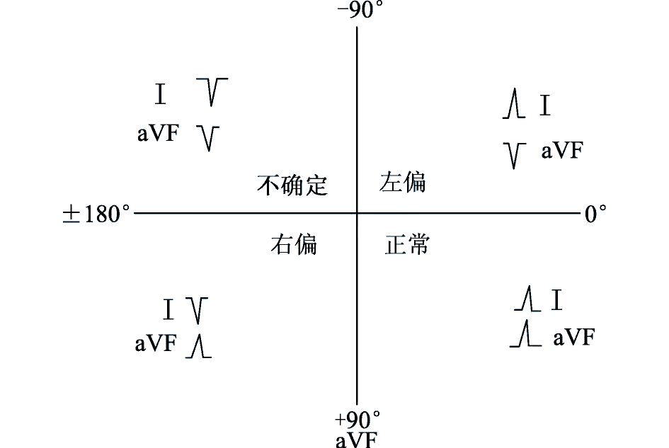心脏电轴的形成原理与测量方法详解