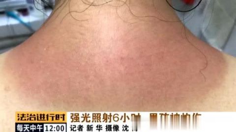 男孩学钢琴被时被紫外线灯灼伤!律师:学校应该承担责任
