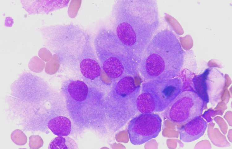 成骨细胞与破骨细胞:骨骼健康的守护者