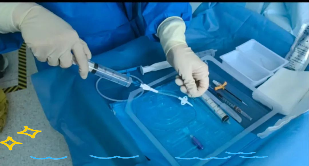 中等长度导管在中短期静脉输液治疗中的优势与应用