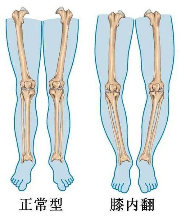 人大腿骨形状图片