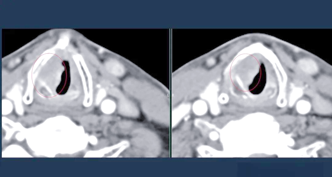 病例介绍及诊断要点详解