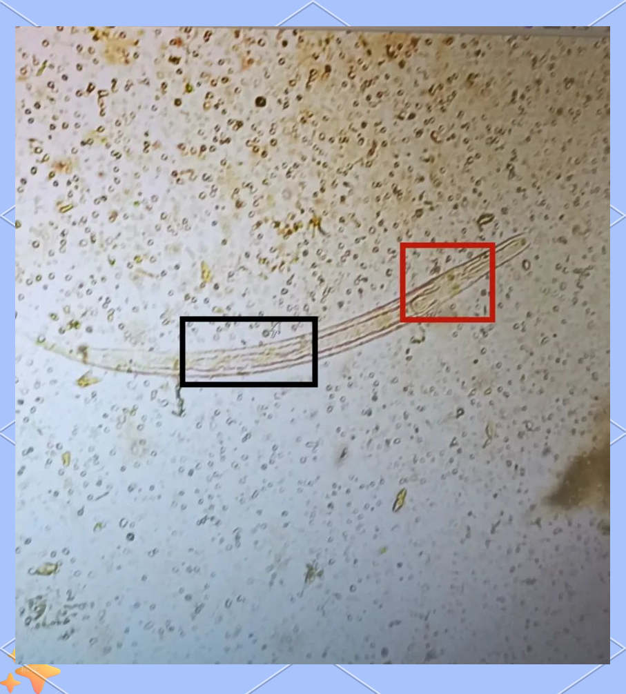 探秘显微世界:识别并了解粪类圆线虫
