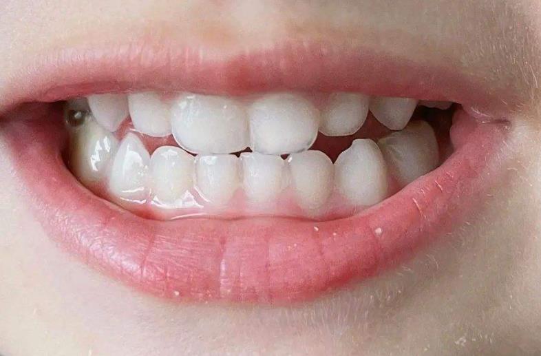 如何让儿童拥有健康整齐的牙齿?口腔医生:必须做到这4点