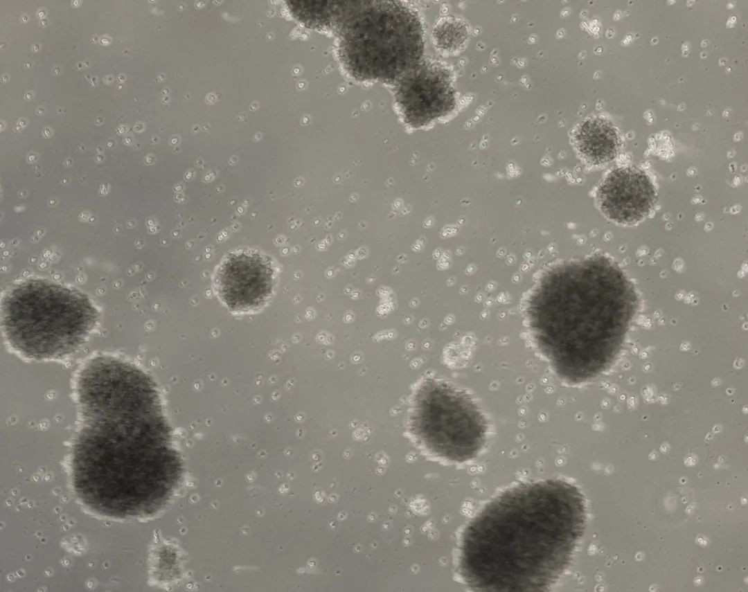 nk-92细胞(人恶性非霍奇金淋巴瘤患者的自然杀伤细胞)培养教程