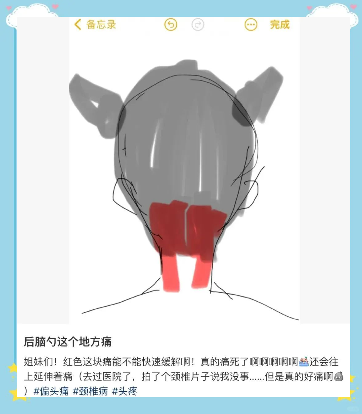 解决后脑勺不适:了解枕下肌群作用与放松方法