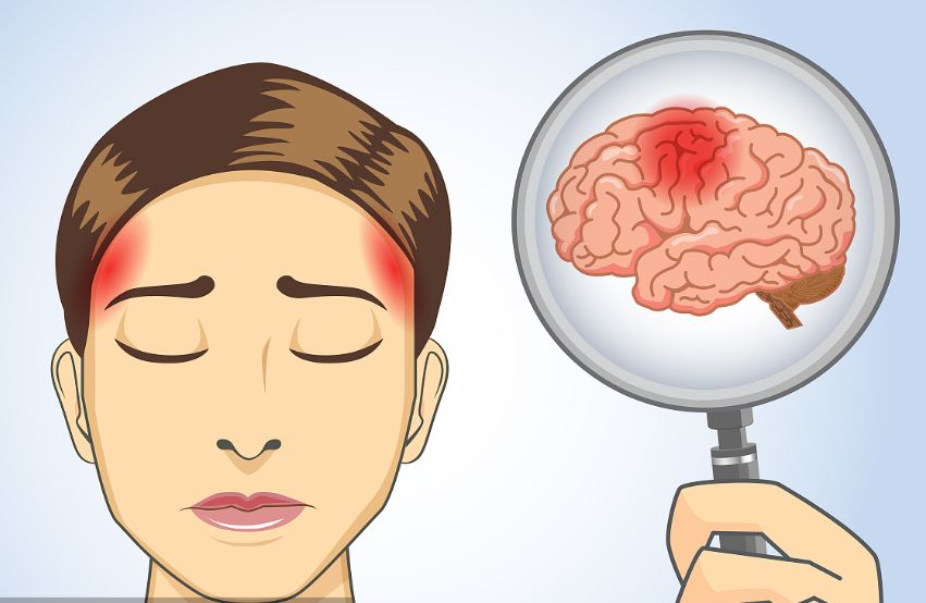 「健康科普」如何治疗创伤后癫痫?