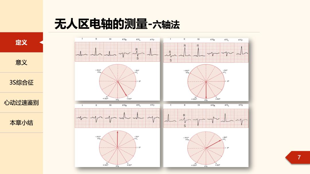 老生常谈丨无人区电轴,曾被人遗忘的角落