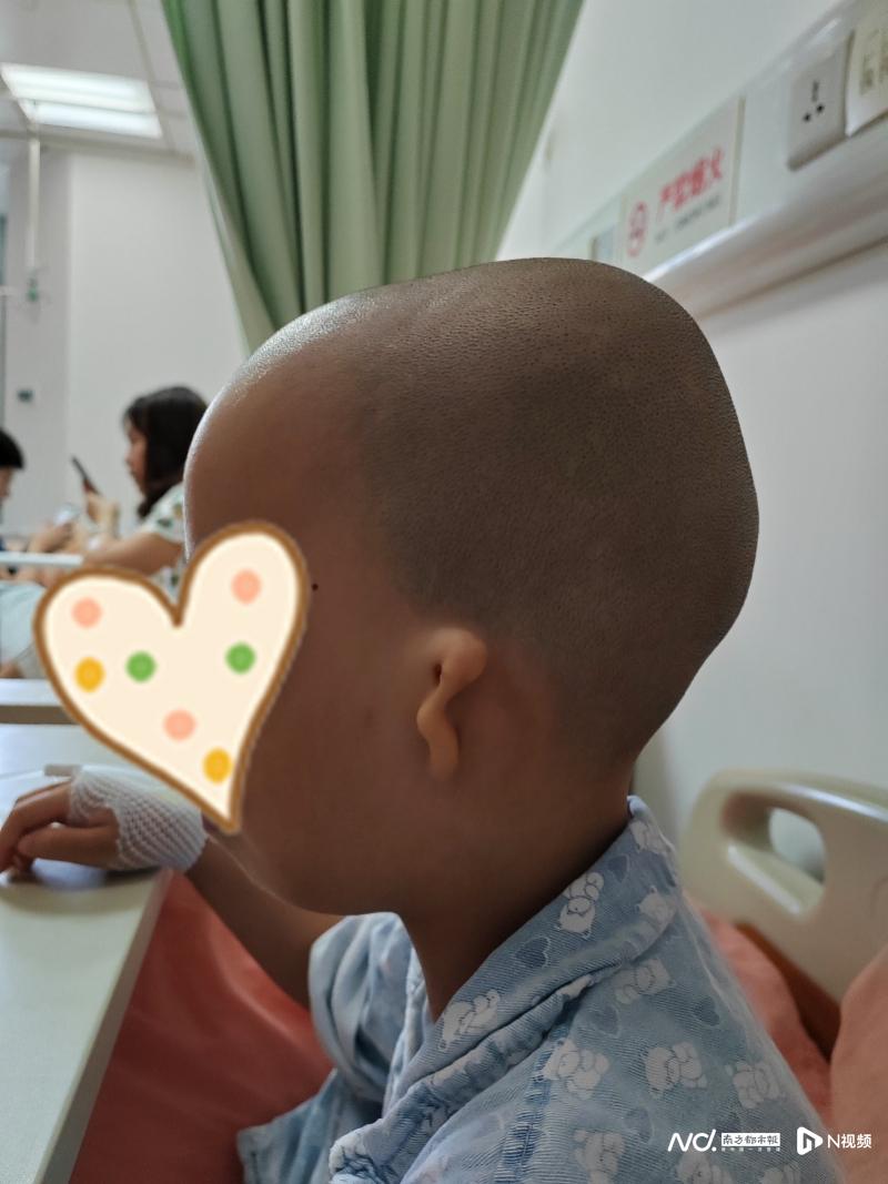 罹患鸟面综合征失聪,公益资助下手术让女孩"听见春天"