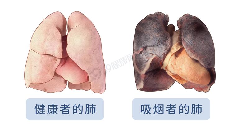 抽烟与不抽烟的肺图片图片