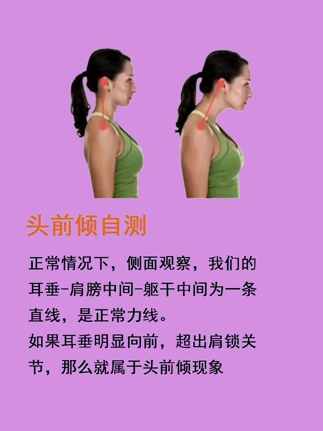 头前倾,可不是小问题