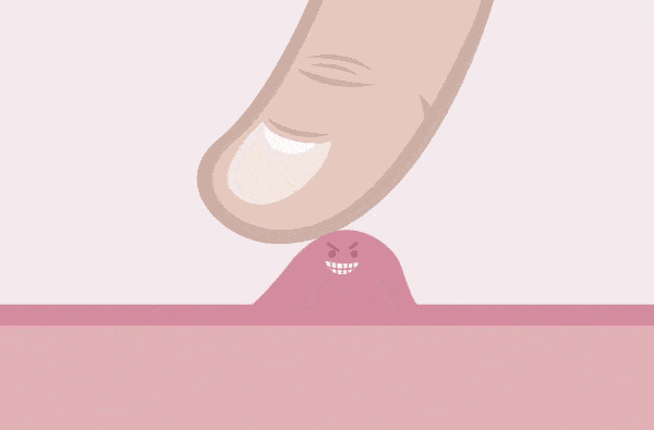 敏感浑身战栗起鸡皮疙瘩的简单介绍