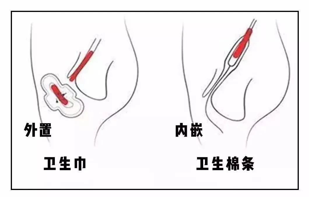 四角裤怎么垫卫生巾图片