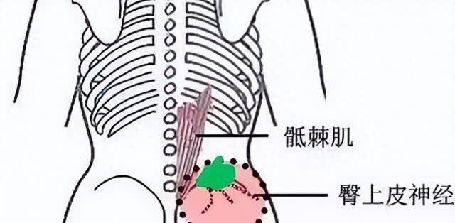 抽骨髓部位图片