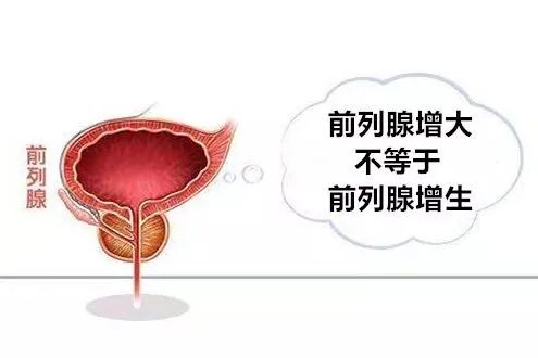 前列腺稍大 baijiahao.baidu.com