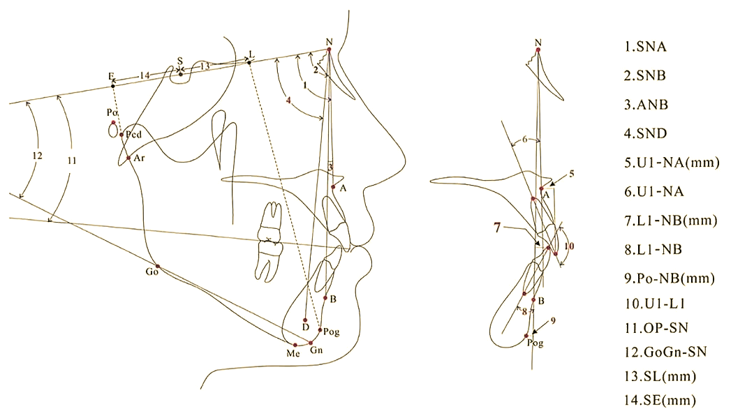 正畸前的秘密:头影测量为何如此重要