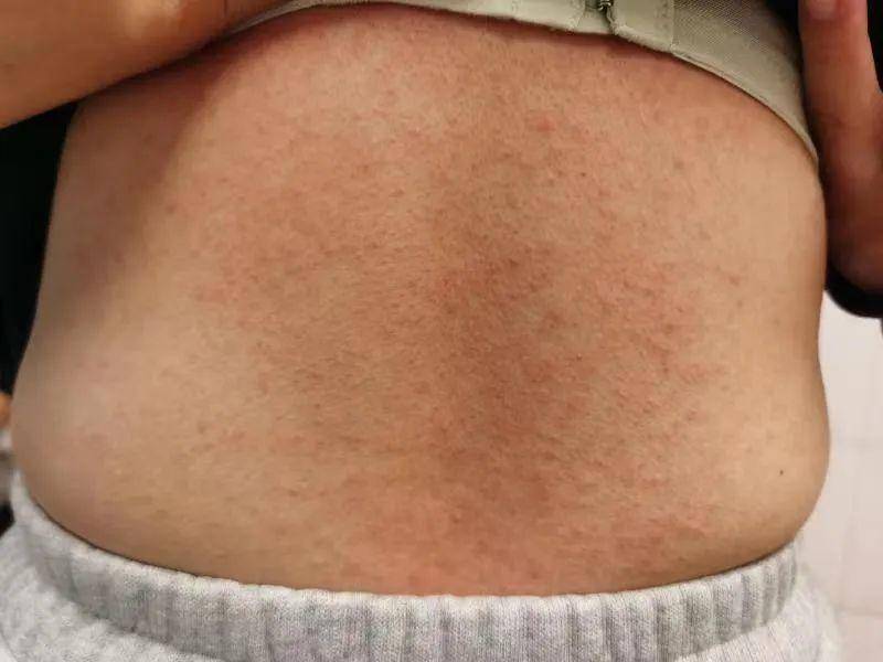 放好药物!小狗误食6粒布洛芬后死亡