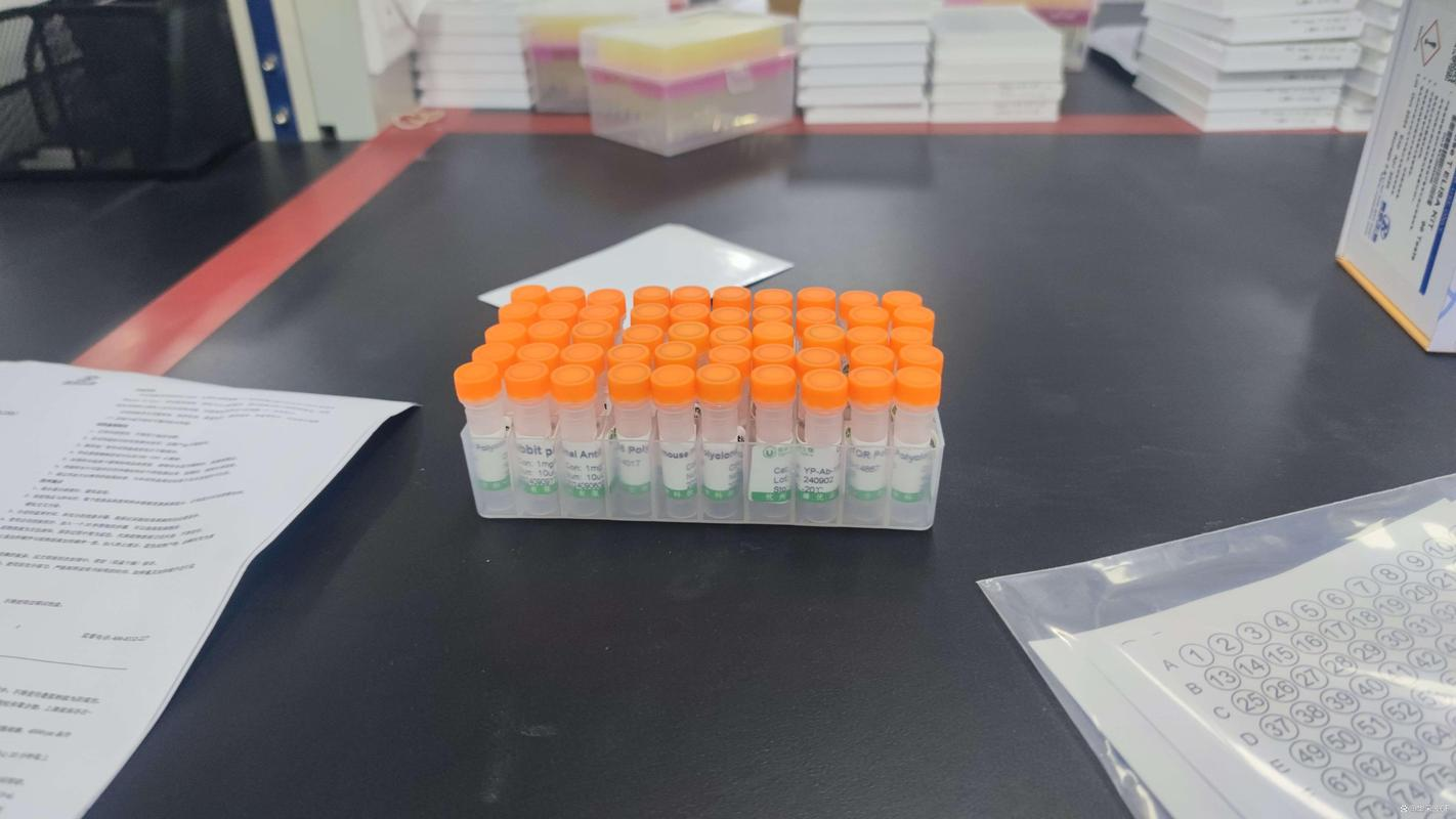 抗双链dna抗体:狼疮诊断的关键指纹