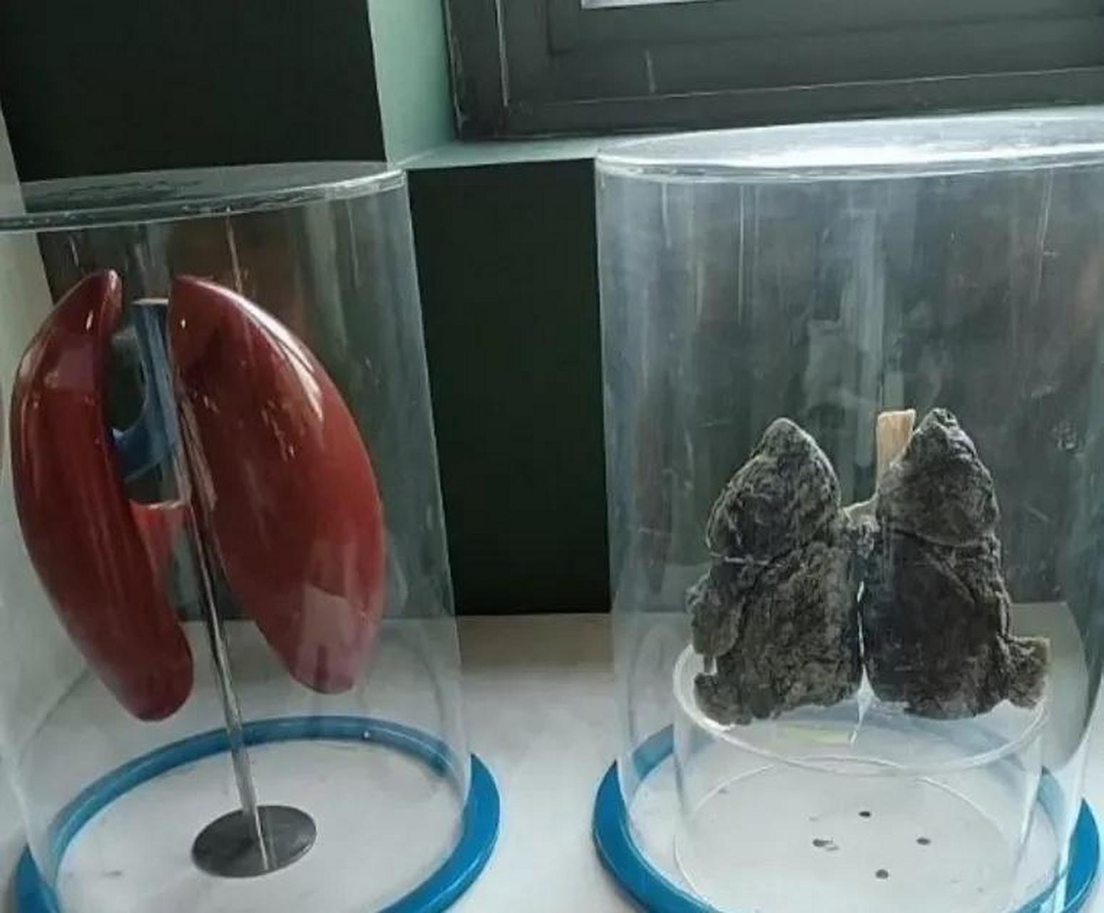 抽烟三十年和不抽烟的肺的区别,抽烟们同胞们好好看看吧.