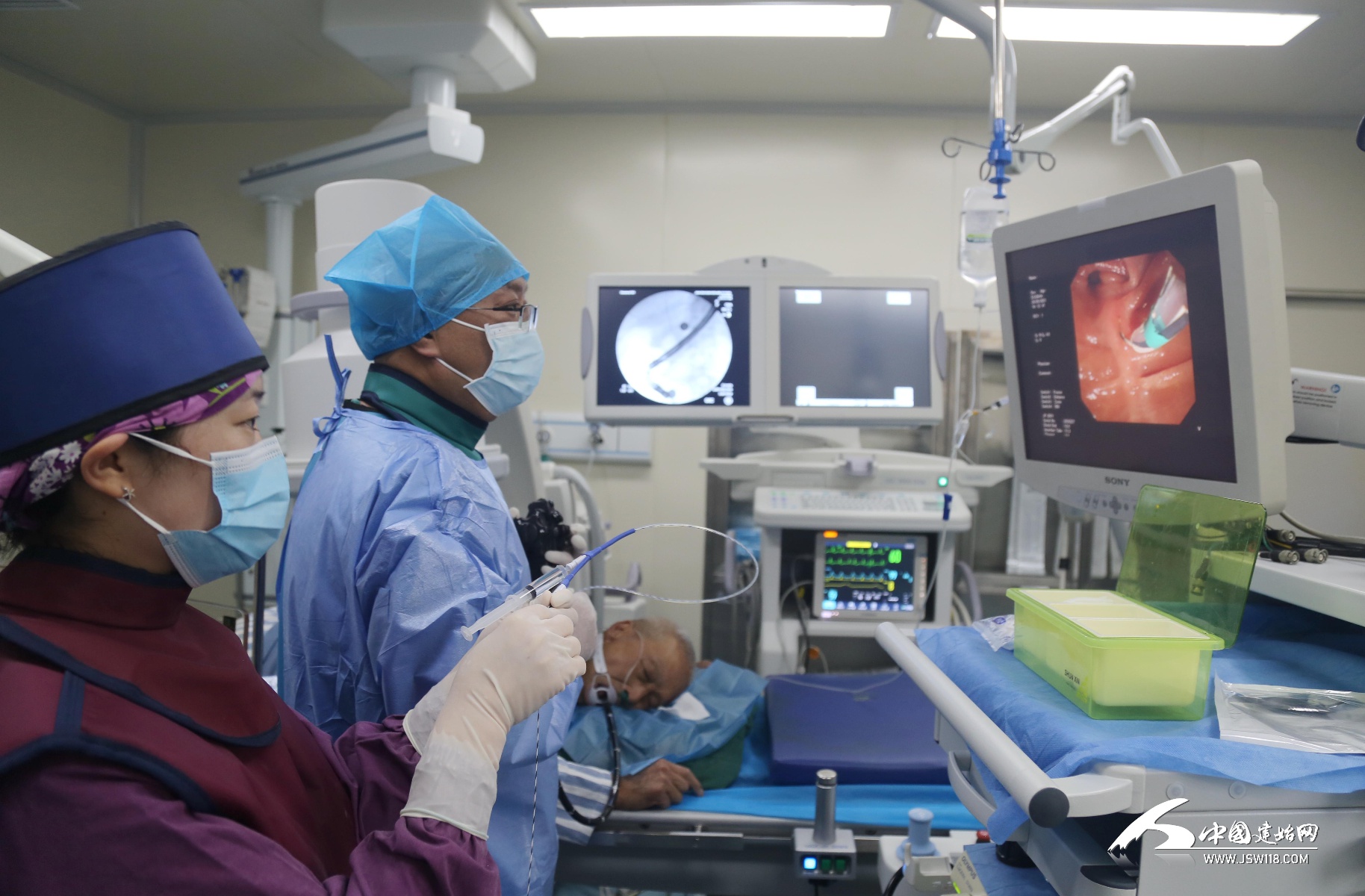 不开刀 不切口 内镜黑科技ercp轻松取出胆总管结石