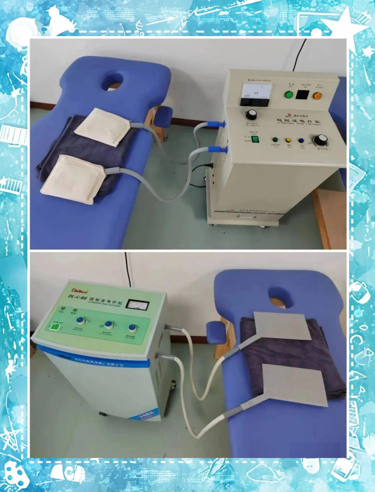 超短波疗法,一种利用频率介于30至300mhz,波长1至10米的电流来治疗