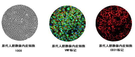 原代人脐静脉内皮细胞