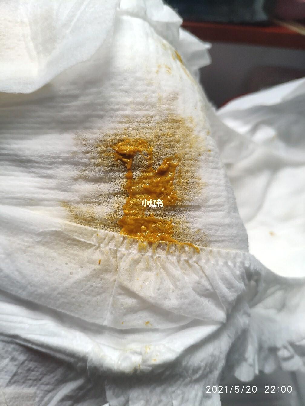 0-1岁的宝宝,身体是否健康,看看粑粑就知,黄金粑粑,妈妈最