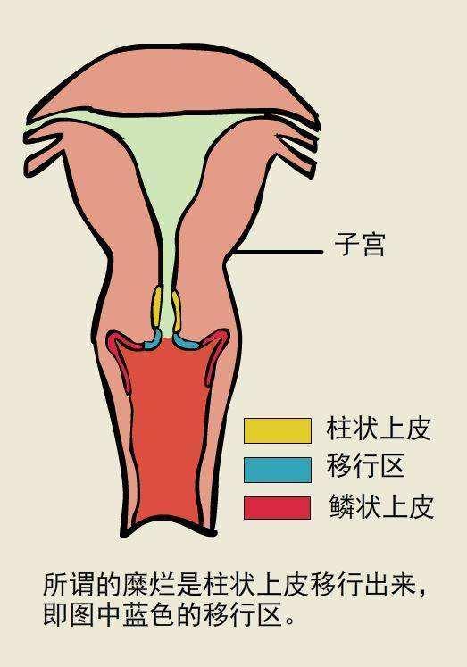 宫颈上唇和下唇图片图片