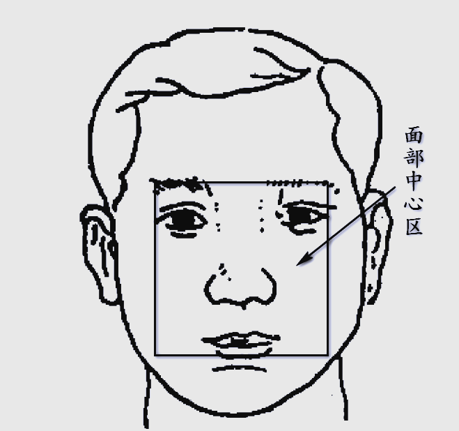双侧外眦处各作一条垂直线,这四条线所围成的中央区域即为面部中心区