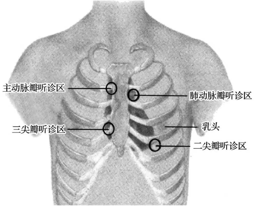 肺部听诊的部位及顺序图片