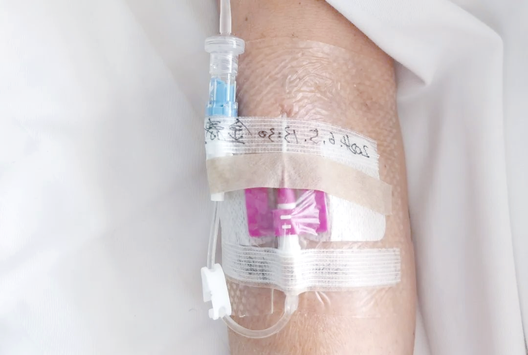 迷你中长导管:创新静脉输液技术带来更佳护理体验