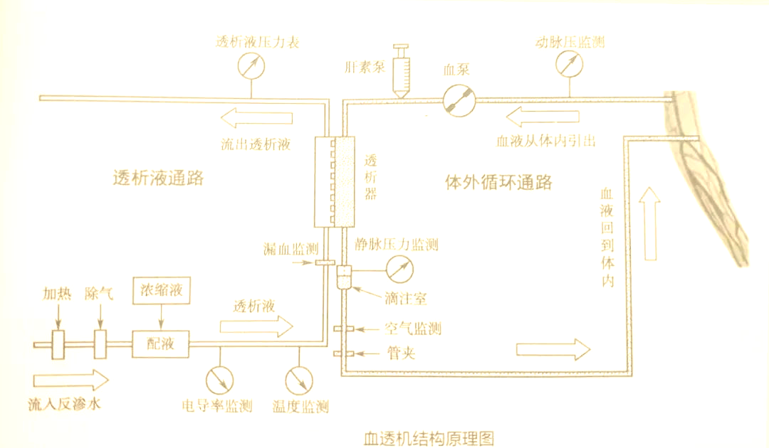 血液透析机的工作原理与功能详解