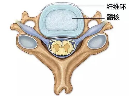 幹細胞移植改善椎間盤退變的研究現狀及臨床案例