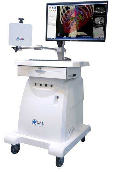 将精准外科与ai和机器人技术相结合,「edda健康科技」完成1.