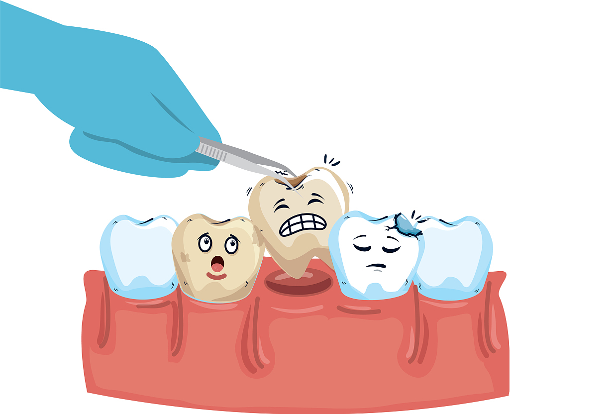 牙齿松动了,应该拔掉吗?