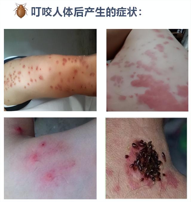 臭虫防治怎么做?