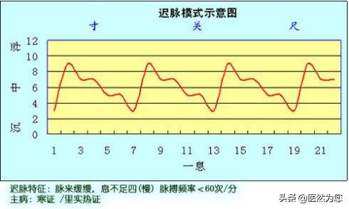 迟脉,缓脉,涩脉和结脉四种脉象,为您分析各代表了什么身体状况