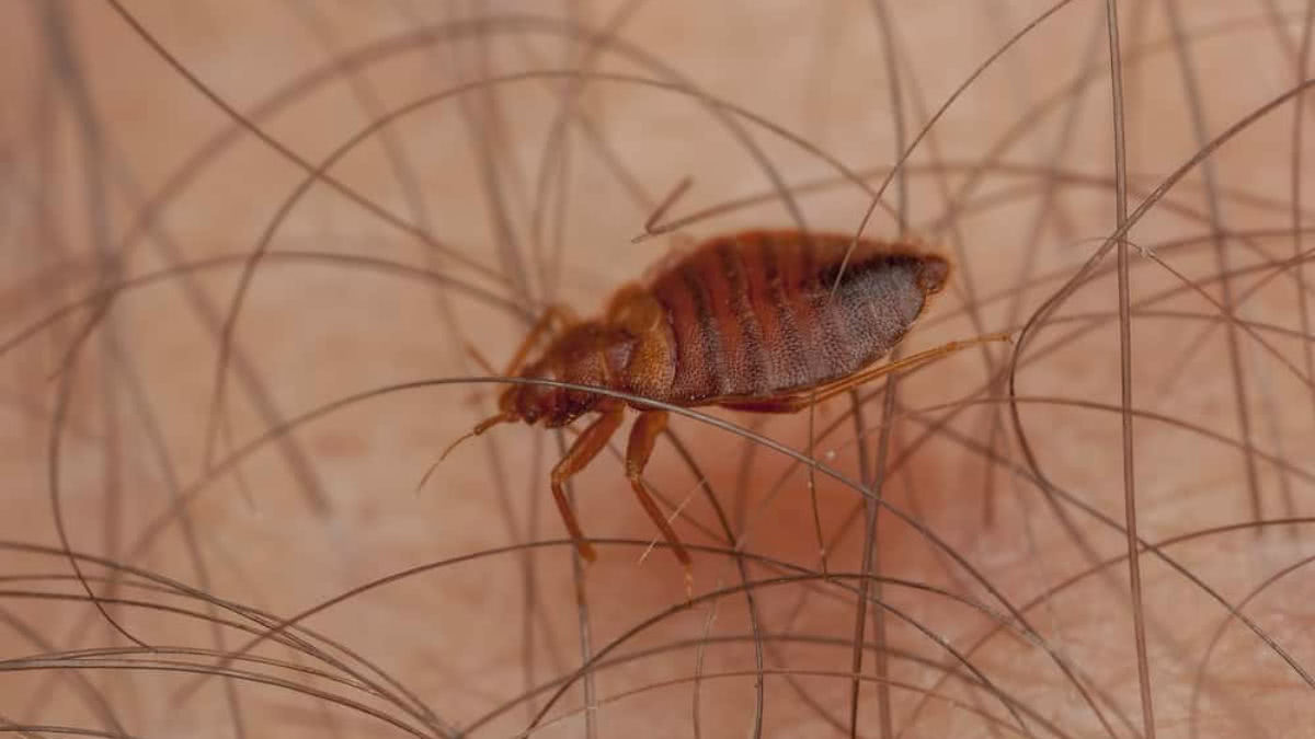 人类为什么不像其他动物一样满身毛发?竟是保持了幼儿的状态!